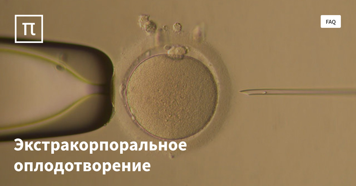 Экстракорпоральное оплодотворение — все самое интересное на ПостНауке