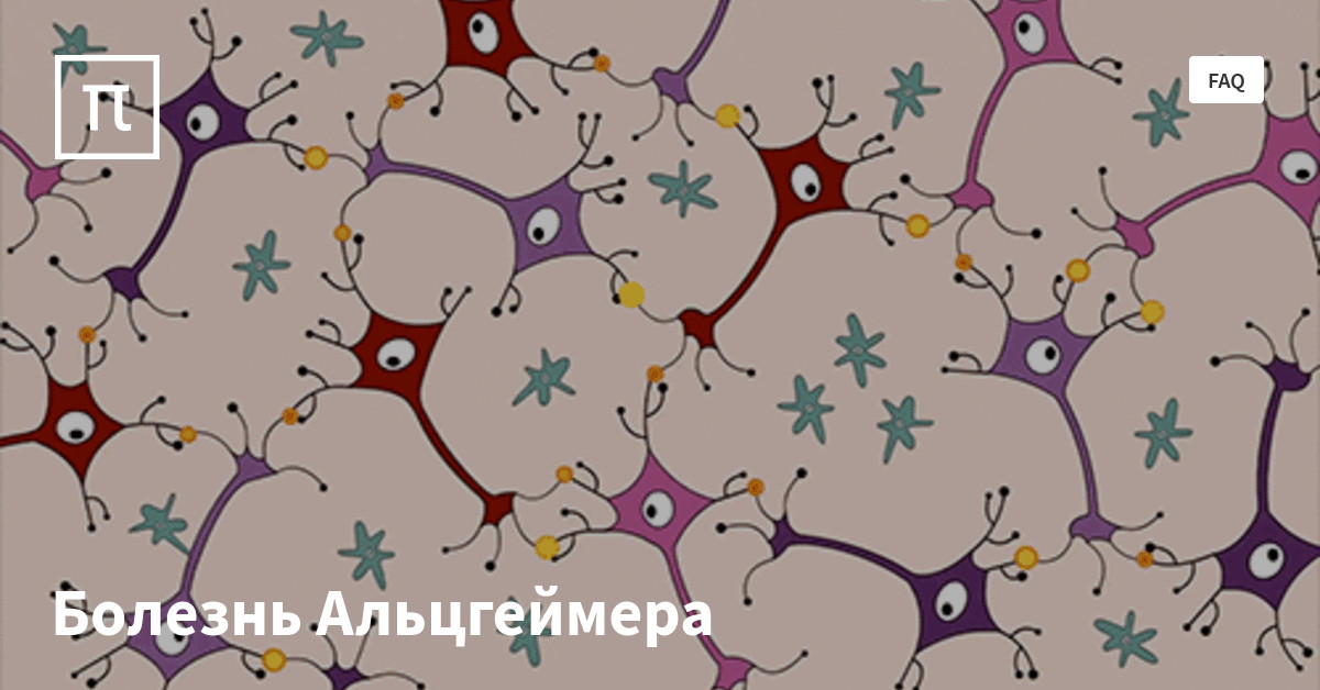 Болезнь Альцгеймера — все самое интересное на ПостНауке