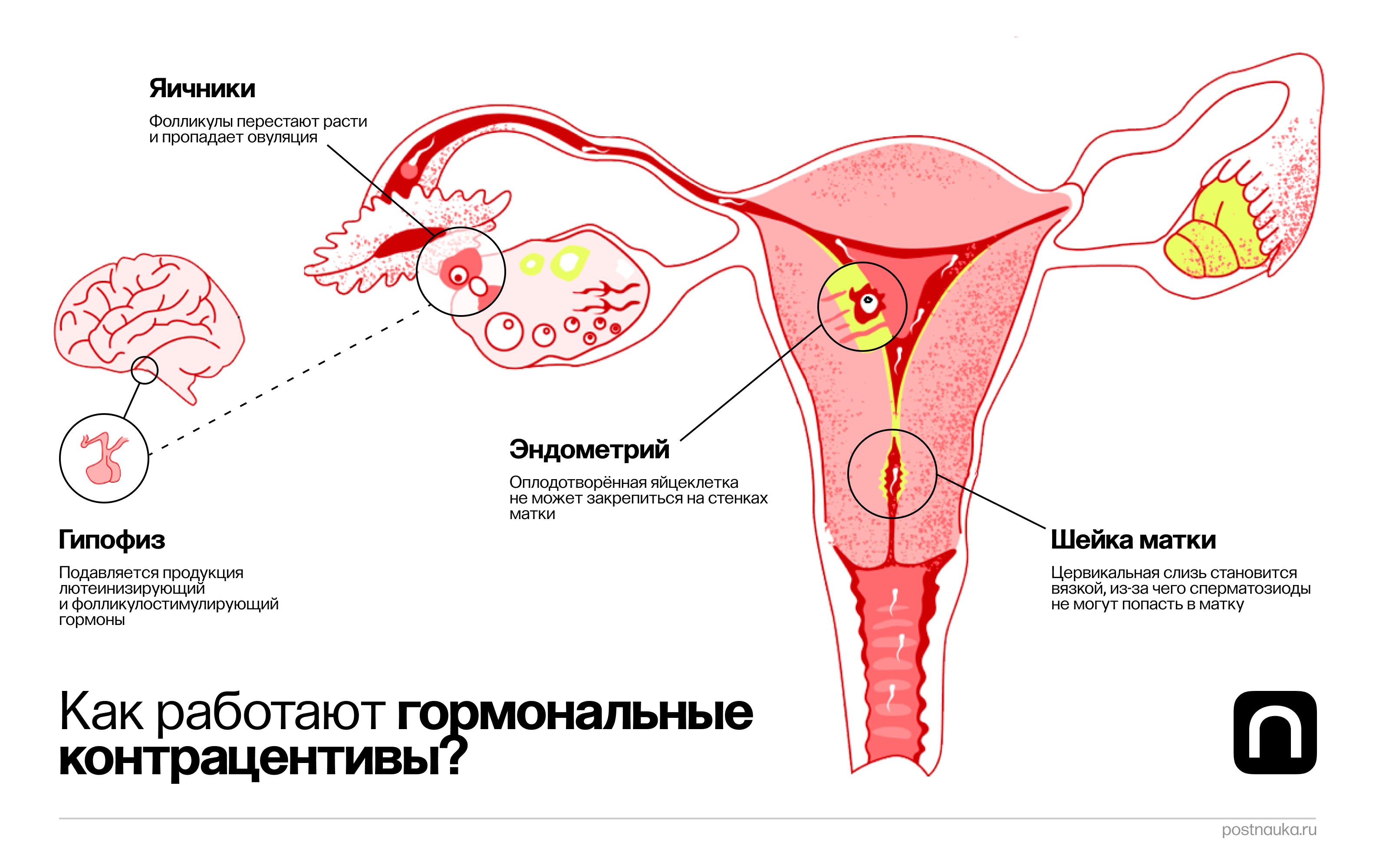 сокращения матки при оргазме беременной фото 115
