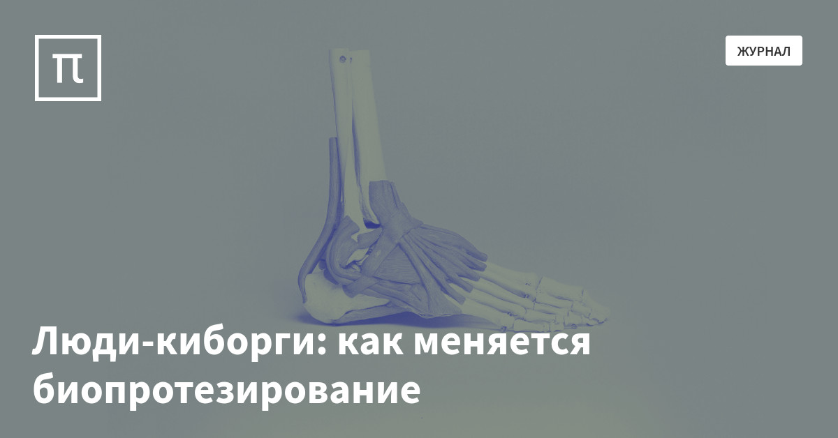 Люди-киборги: как меняется биопротезирование — все самое интересное на ...