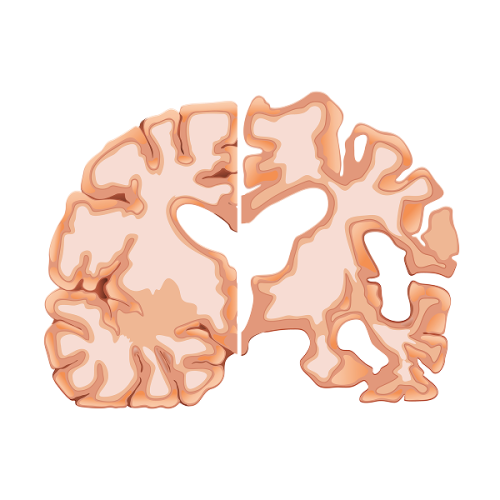 изображение для темы bolezn-altsgeymera