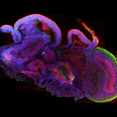 Органоиды мозга