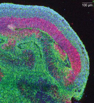 Срез одного «долькового» участка кортикальной ткани внутри органоида (нейроны