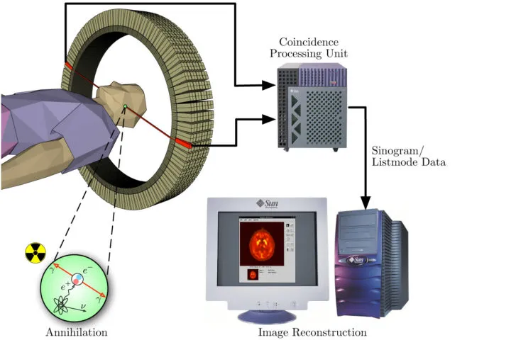 Схема позитронно-эмиссионной томографии