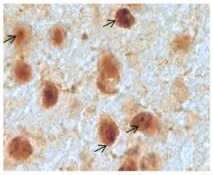 Агрегаты гентингтина в мозге мыши (отмечены стрелками)