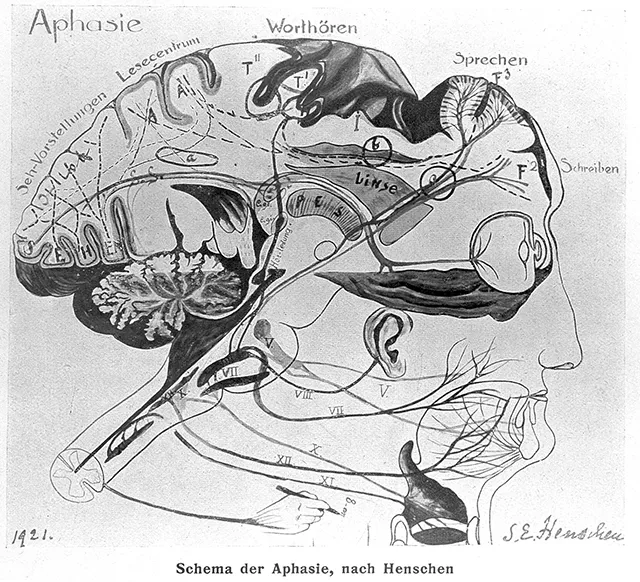 Схема мозга при афазии. 1921 год.