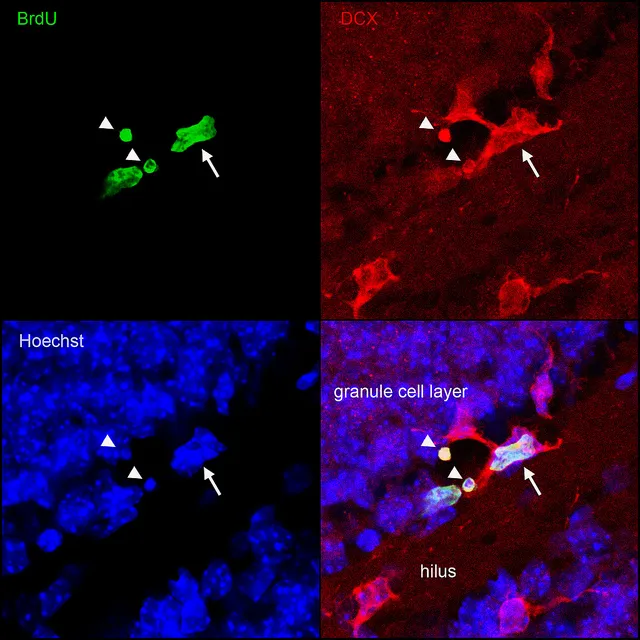 Лонгриды: Что происходит в мозге, когда человек учится