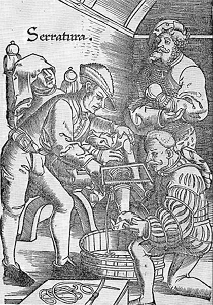 Врачеватель ран проводит ампутацию ноги опьяненного