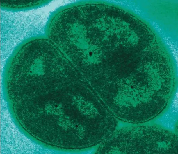Deinococcus radiodurans, одна из самых устойчивых к радиации бактерий