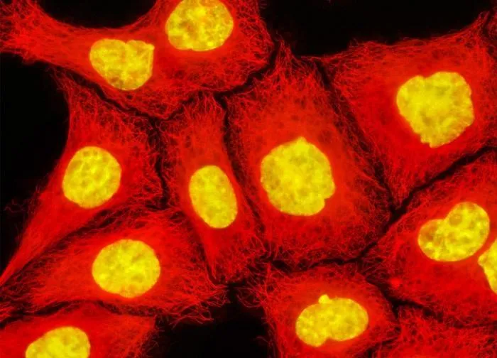 Клетки аденокарциномы шейки матки человека (клеточная линия HeLa)