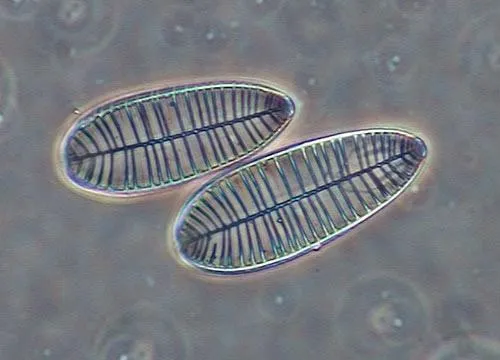 Диатомовые водоросли Surirella