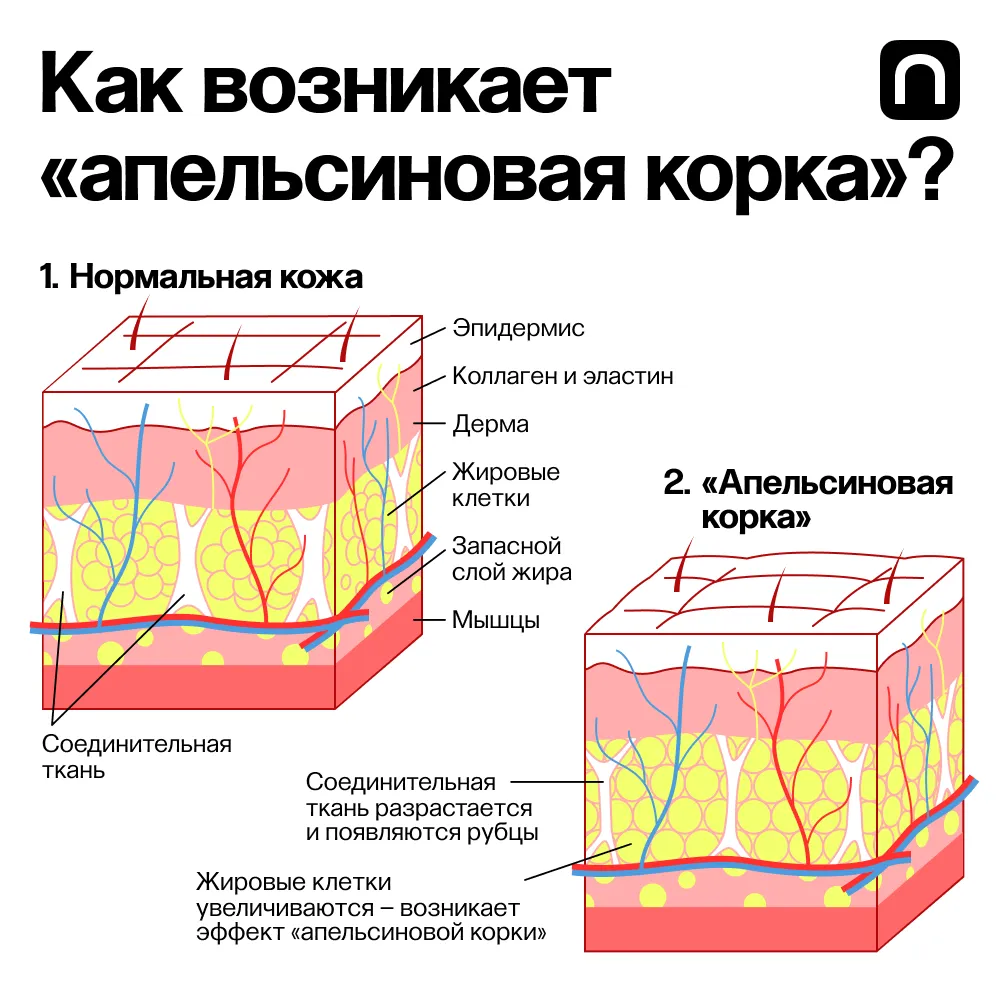 Екатерина Золотарева для ПостНауки
