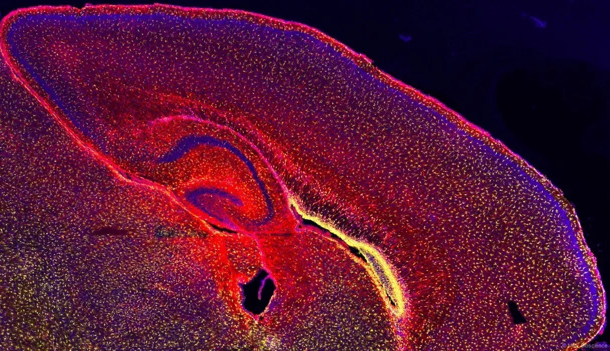 Незрелые астроциты (желтые) мигрируют в верхние слои коры мозга мыши из желудочковой зоны с помощью расширений GFAP (красный), где они затем делятся, чтобы стать наиболее распространенным типом клеток в коре млекопитающих. Credits: Gareth Rurak / neuroart