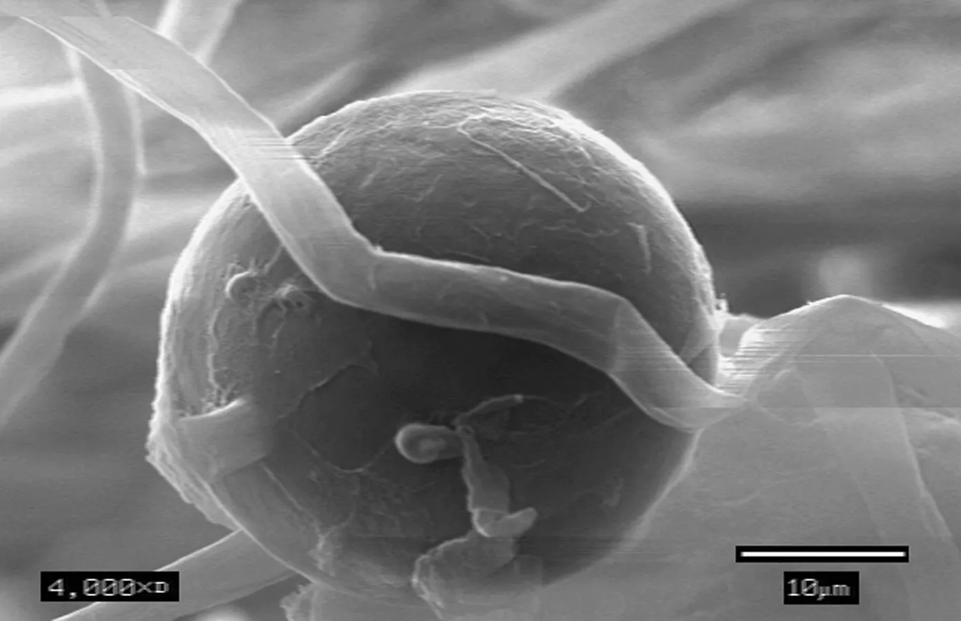 Репродуктивная структура Phytophthora / USDA Forest Service Pacific Southwest