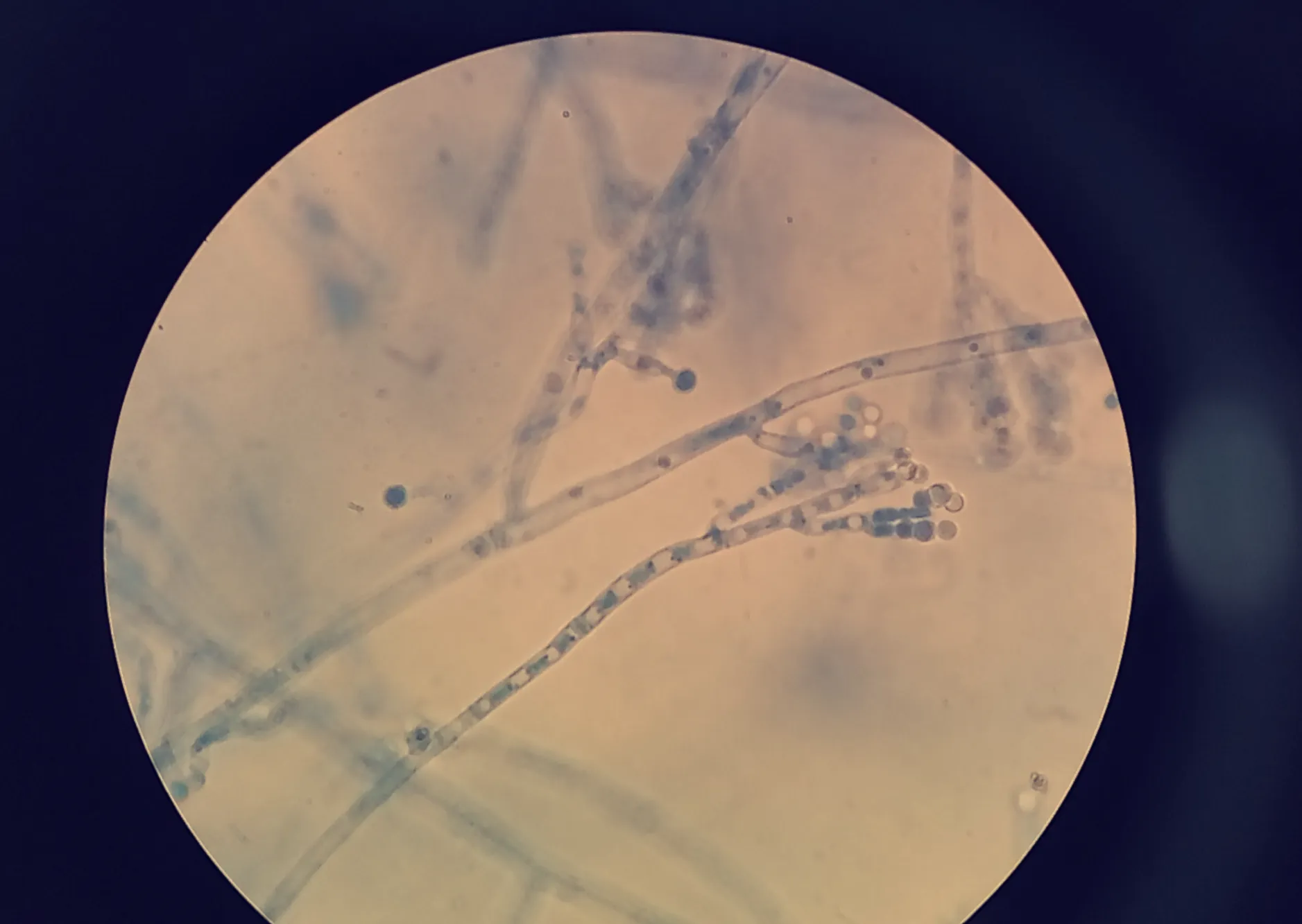 Пенициллин под микроскопом после окрашивания патентованным синим / Louis