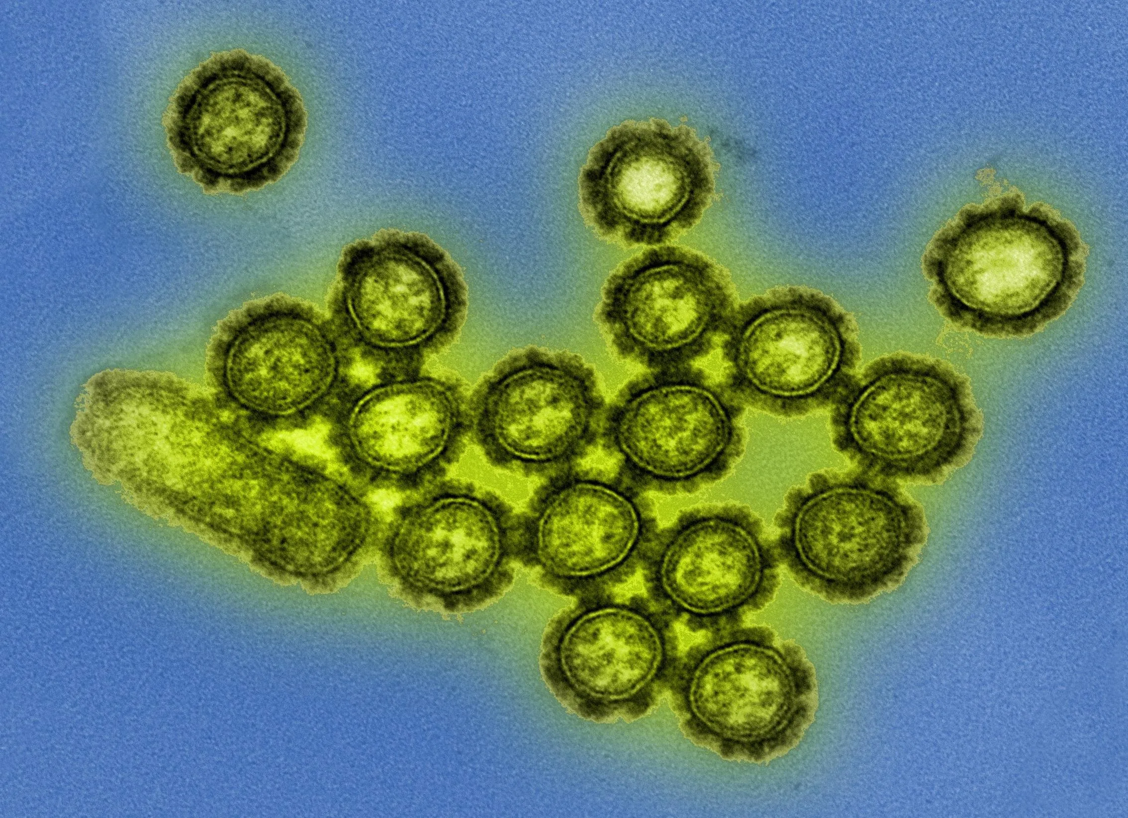 Микрофотография частиц вируса гриппа H1N1 / NIAID