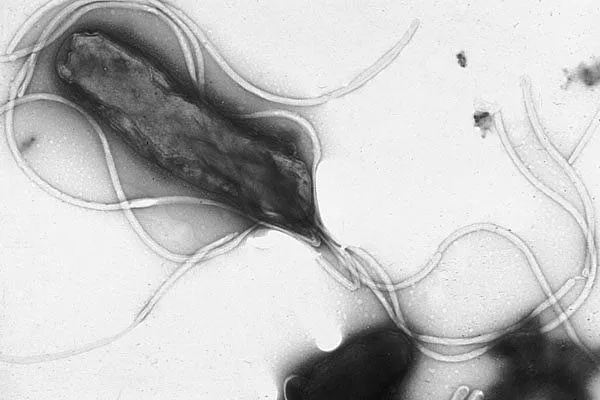 Электронная микрофотография бактерии Helicobacter pylori / Yutaka Tsutsumi,